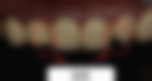 湖南长沙县瑞贝特口腔价格表(仅供参考)