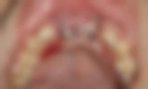 绍兴柯桥钱杨口腔门诊核心项目