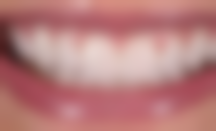 福州仓山盘屿白马口腔门诊部核心项目