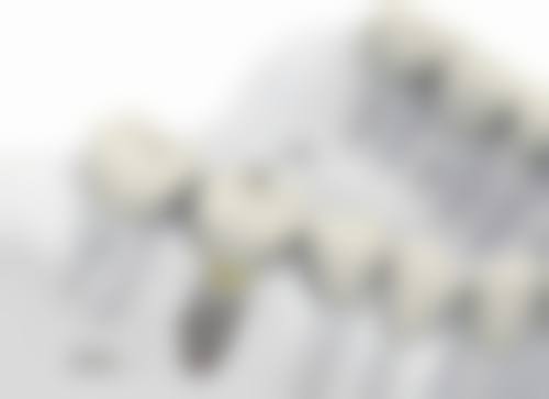 贵阳市口腔医院口腔修复科价格表(仅供参考)