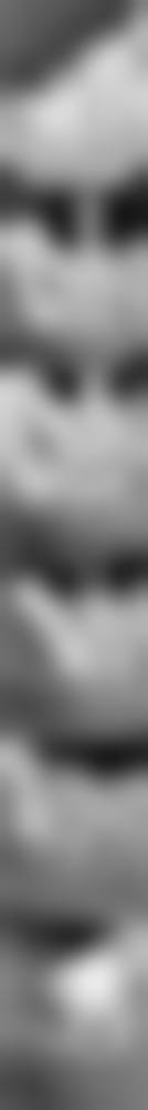 新密雅一生口腔门诊部价格表(仅供参考)