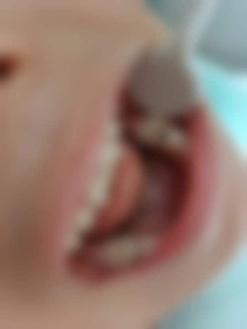 吴燕燕患者评价