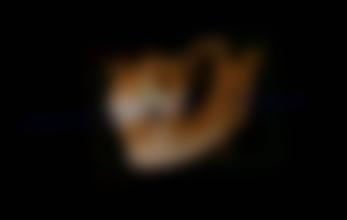 新雨口腔(桥西店)实例参考