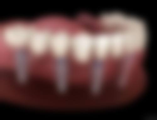 东莞永昇口腔(莞城店)医生团队