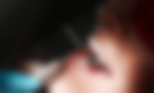 深圳亿美派口腔诊所价格表(仅供参考)