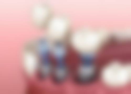 江西九江新博口腔怎么预约？