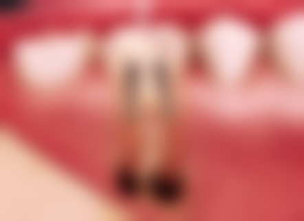 郑州牙博仕口腔医院地址及到院路线