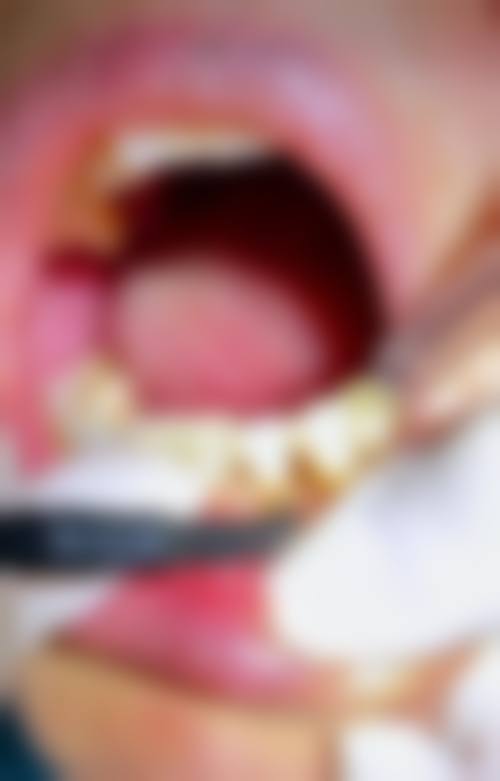 湖南长沙李秀英口腔正规吗？看资质