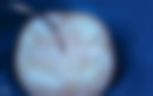 深圳李世广口腔诊所核心项目