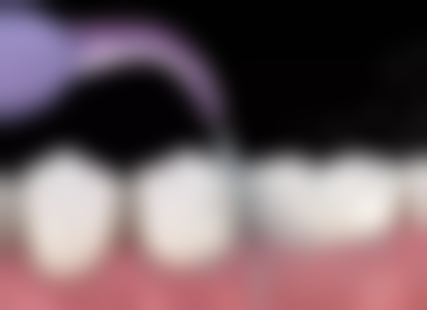 广东潮州众信牙科怎么预约？