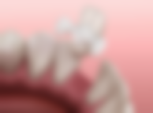 石家庄全博口腔（慢城分院）实例参考