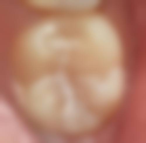 都匀锦雅口腔诊所核心项目