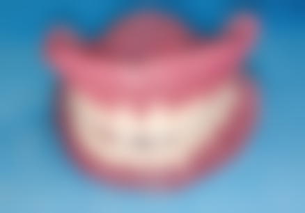 广东广州花都鹏博口腔价格表（仅供参考）