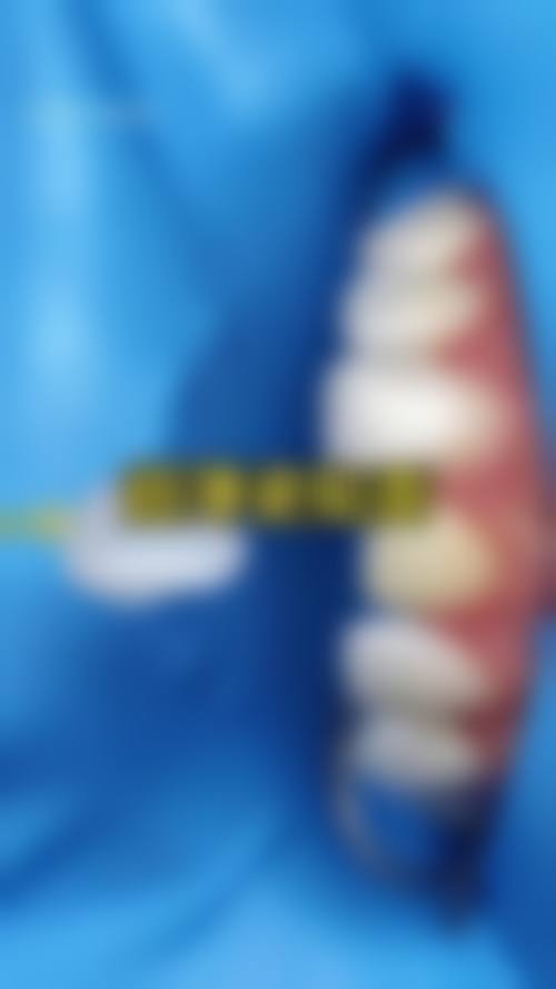 汉中静齿健口腔诊所实例参考