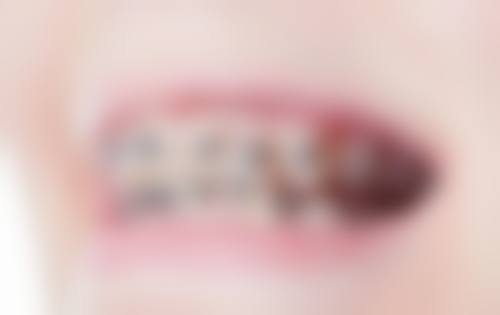 湖南娄底正容牙科怎么预约？