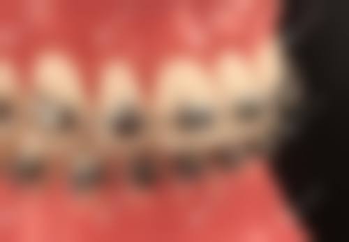 湖南娄底正容牙科地址在哪？