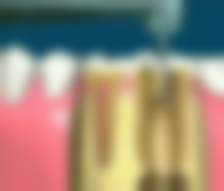 广东惠州凯尔口腔核心项目