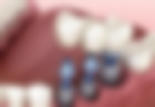 天津红桥福鑫口腔门诊部价格表（仅供参考）