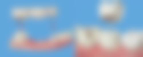 广州花都港附口腔技术设备怎么样？