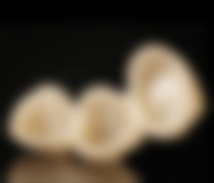 天津晶美佳口腔诊所实例参考