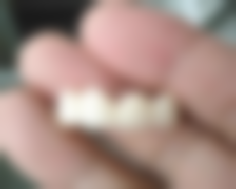 天津晶美佳口腔诊所核心项目