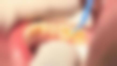 宁乡贝尔口腔口碑评价