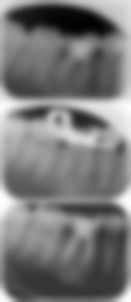 武汉市第四 医院口腔科口碑评价