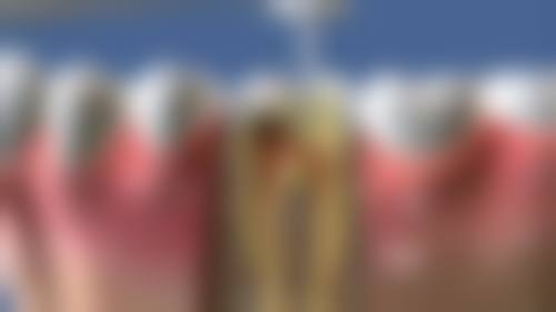 宁波陈佳囡口腔医生团队解析