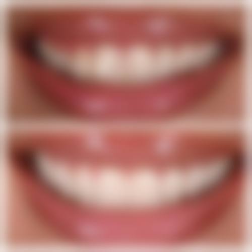 张秋焕预约方式及价格表