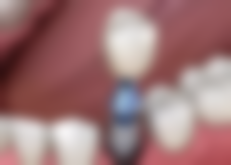 靳东亮擅长项目列表