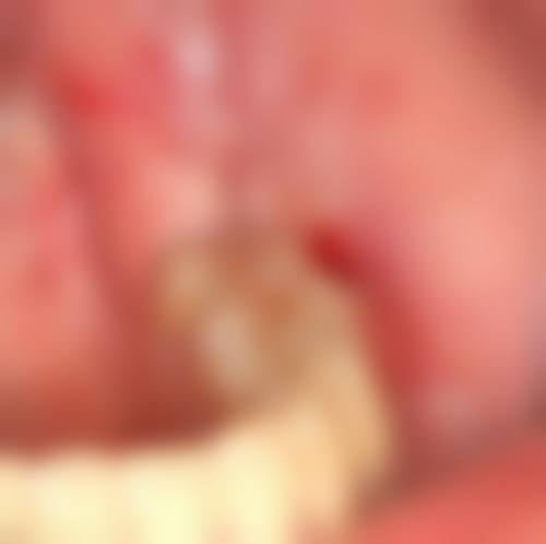 杭州德奥口腔(余杭店)擅长项目有哪些?