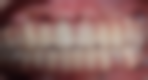 刘玉超擅长项目列表