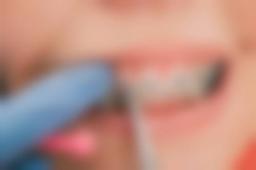 西湖口腔医院擅长项目有哪些？