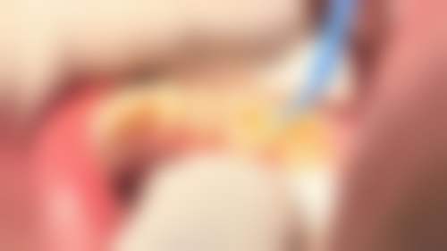 重庆诚佳泰口腔口碑评价