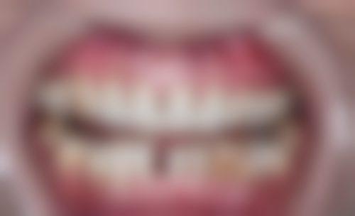 天津勃朗口腔门诊医生团队解析