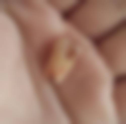 广东广州祈福口腔医生团队解析