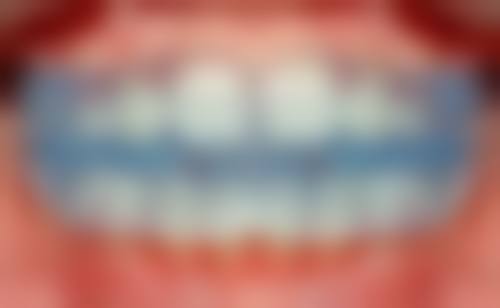 重庆北碚亦菲欧口腔2026价格表参考