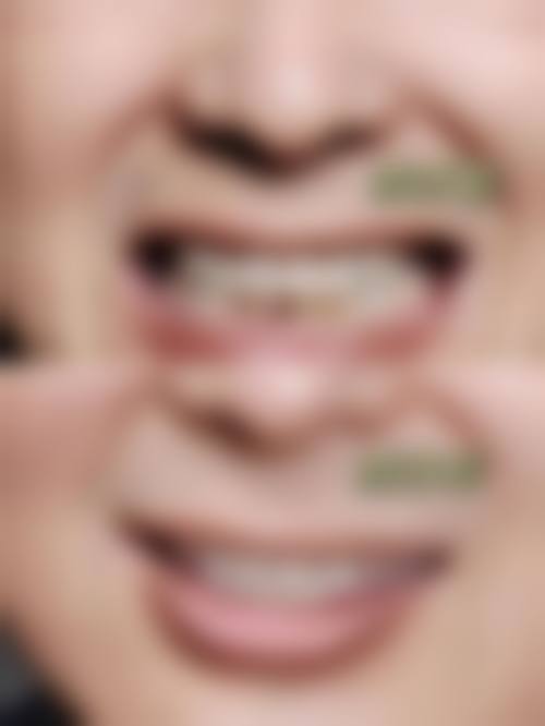 维乐口腔（虹口分店）擅长项目有哪些？