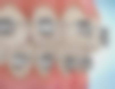 维乐口腔（虹口分店）医生团队解析