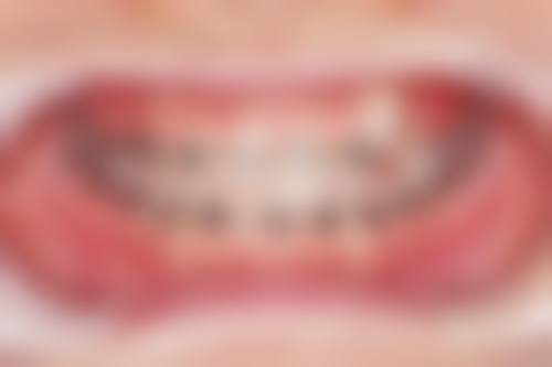 昆明英茂口佳家口腔连锁技术设备怎么样？