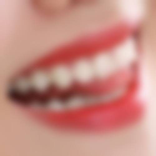 昆明英茂口佳家口腔连锁2026价格表参考