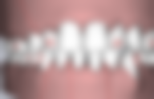 重庆众植博仕口腔门诊部（璧山店）口碑评价