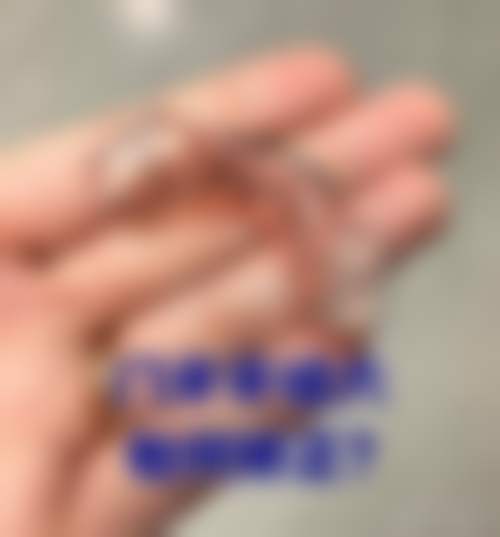 南京思美尔口腔门诊部医生团队解析