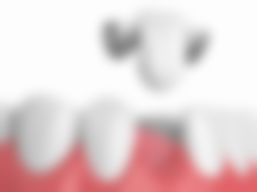 安庆市第一人民医院口腔科2026价格表参考