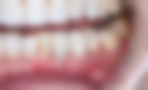 江苏苏州昆山雅道口腔2026价格表参考