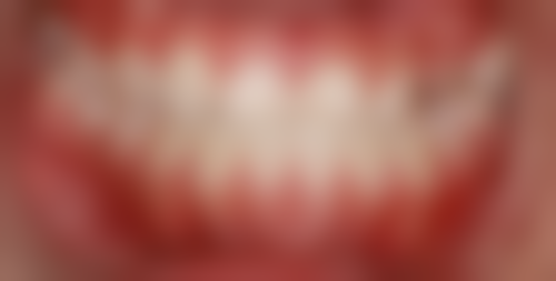 安庆市第一人民医院口腔科口碑评价