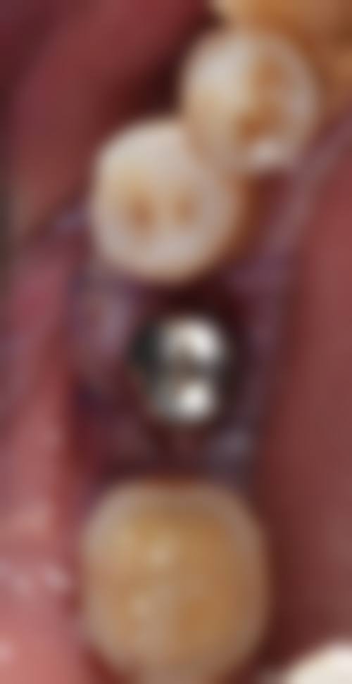 长沙天天有口腔医院(人民路总院)2026价格表参考