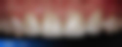 厦门优梨口腔门诊部医生团队解析