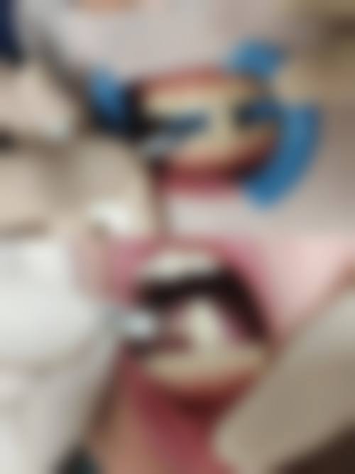 重庆大渡口卫影口腔诊所2026价格表参考