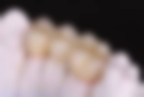 徐垲垒擅长项目列表